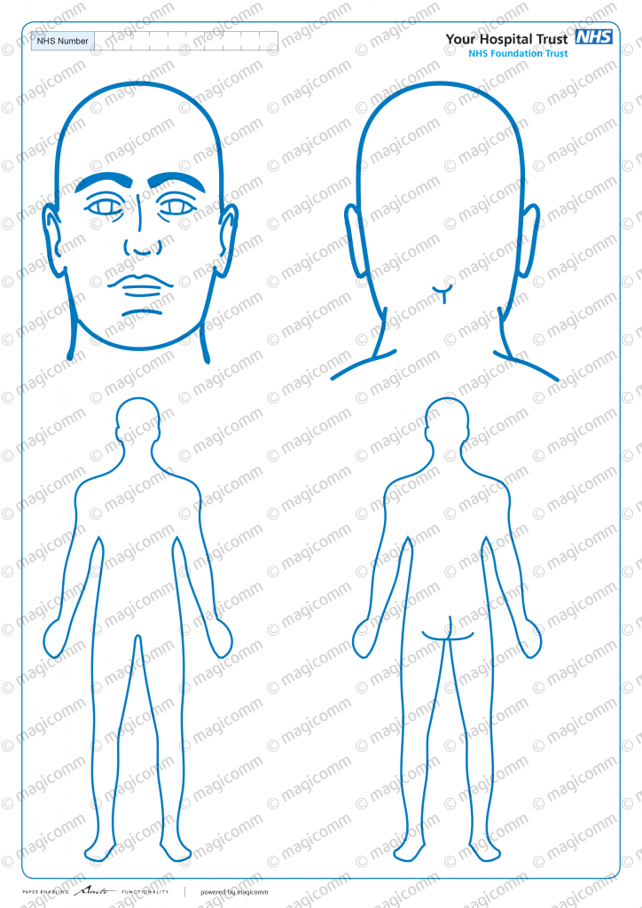 Chart Body Diagram